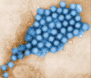 Norovirus  Image/CDC