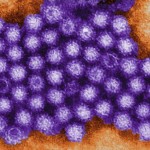 Norovirus Image/CDC
