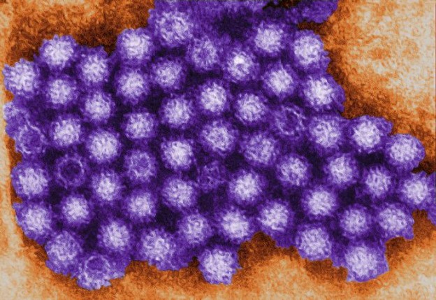 Norovirus Image/CDC