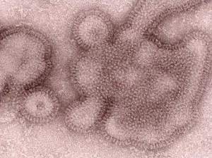 This transmission electron micrograph (TEM) depicts some of the ultrastructural details displayed by H3N2 influenza virions  Image/CDC