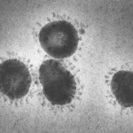 An example of a coronavirus-this one infects poultry Credits:   CDC