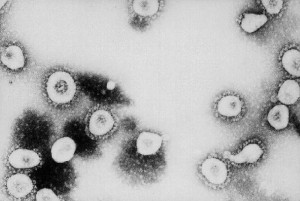 This transmission electron micrograph (TEM) revealed the presence of numbers of coronavirus OC43 virions.  Image/CDC