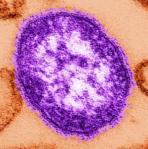 Measles virus Image/CDC