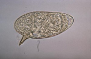 Schistosoma mansoni egg Image/CDC