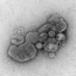This negatively-stained transmission electron micrograph (TEM) captured some of the ultrastructural details exhibited by the new influenza A (H7N9) virus. Image/CDC