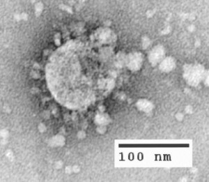 Coronaviruses are a group of viruses that have a halo or crown-like (corona) appearance when viewed under a microscope. Image/CDC