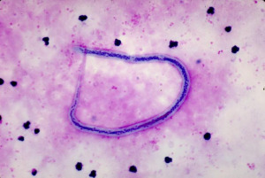 Wuchereria bancrofti microfilariae Image/CDC