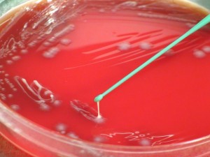 Yersinia pestis bacteria, which was grown on a medium of sheep’s blood agar (SBA) Image/CDC