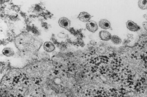 Human immunodeficiency virus (HIV), co-cultivated with human lymphocytes. Image/CDC