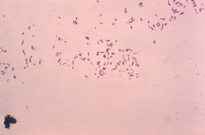 R. equi long known as an important pathogen of immature horses, has become in the past three decades an opportunistic pathogen of severely immunosuppressed humans. Image/CDC