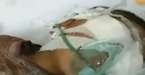 Chinese boy bandaged after organ traffickers reportedly stole his eyes Image/Video Screen Shot 