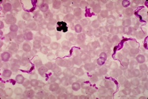 Trypanosoma brucei parasites Image/CDC
