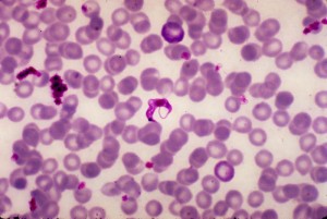 Trypanosoma cruzi in a blood smear Image/CDC