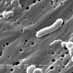 Vibrio cholerae Image/CDC/ Janice Carr