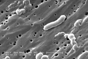 Vibrio cholerae Image/CDC/ Janice Carr
