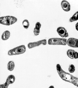 Bacillus anthracis under TEM/CDC