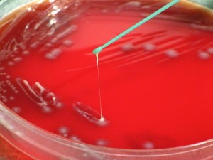 Yersinia pestis bacteria grown on sheep blood agar  Image/Pete Seidel