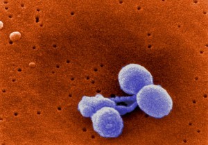 Scanning Electron Micrograph of Streptococcus pneumoniae/CDC