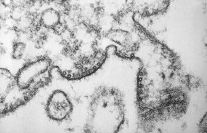 This transmission electron micrograph (TEM) revealed some cytoarchitectural changes in an unknown human-derived tissue sample associated with a Nipah virus infection./CDC