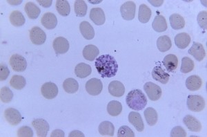 Simian malaria Image/CDC