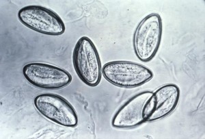 E. vermicularis image/CDC