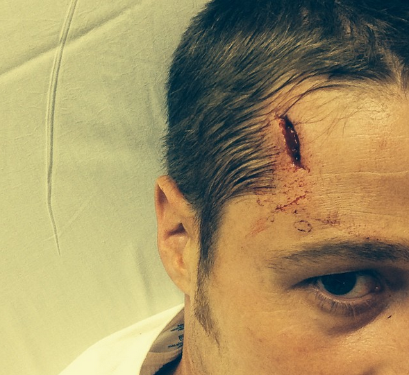 Ben McKenzie shares his head injury with fans via Instagram