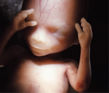photo: 14 week fetus photo/ Your Pregnancy week by week