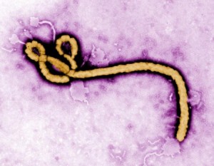 Ebola virus  Image/CDC