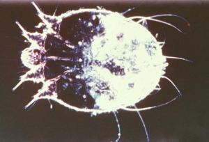 scabies, itch mite