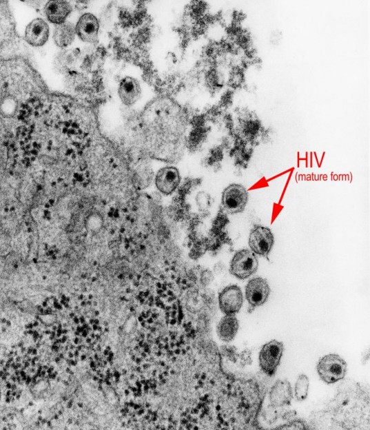 HIV Image/CDC