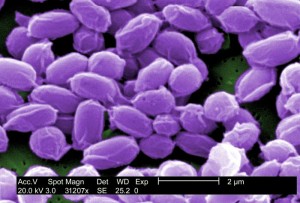 Anthrax image/Janice Carr-CDC