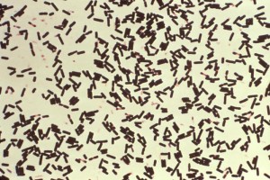 Clostridium perfringens gram stain Image/CDC