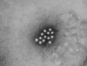 Hepatitis AImage/CDC
