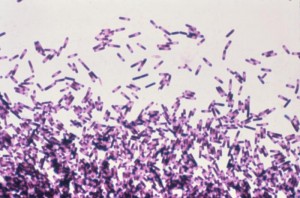 Clostridium difficile Image/CDC