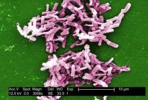 Clostridium difficile Image/CDC/Janice Carr