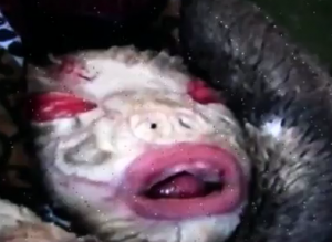 Malawi baby with harlequin icthyosis Image/Video Screen shot