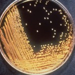 Vibrio cholerae on TCBS agar. Photo/CDC