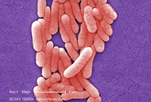 Salmonella image/CDC