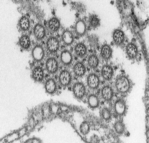 This highly-magnified transmission electron micrograph (TEM) depicted numbers of virions from a Novel Flu H1N1 isolate. Image/CDC