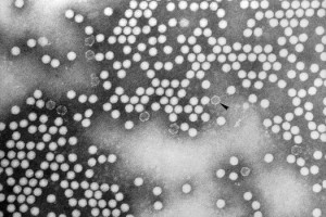 Poliovirus Credits:   CDC