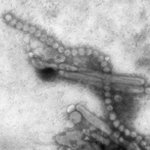 This negatively-stained transmission electron micrograph (TEM) captured some of the ultrastructural details exhibited by the new influenza A (H7N9) virus. Image/Cynthia S. Goldsmith and Thomas Rowe