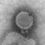 Under a high magnification, this negatively-stained transmission electron micrograph (TEM) captured some of the ultrastructural details exhibited by the new influenza A (H7N9) virus. Image/CDC