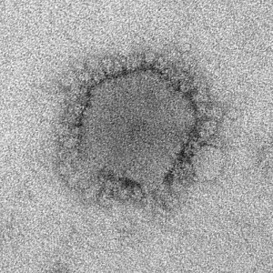  Middle East Respiratory Syndrome Coronavirus (MERS-CoV) Image/CDC