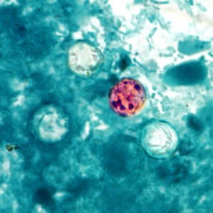  Cyclospora cayetanensis  Image/CDC