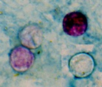 Four Cyclospora oocysts from fresh stool stained using a modified acid-fast stain. Image/CDC (DPDx)