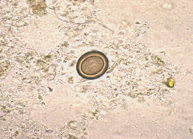 Taenia egg Image/CDC