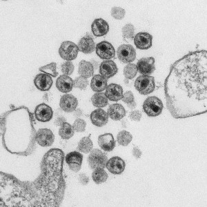 This thin section transmission electron micrograph (TEM) depicts numerous virions revealed in a preparation of HIV (human immunodeficiency virus). Image/CDC