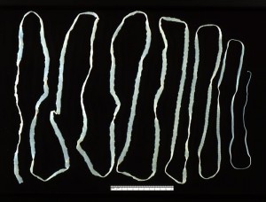 adult Taenia saginata tapeworm Image/CDC