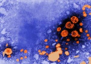 Hepatitis B virions Image/CDC