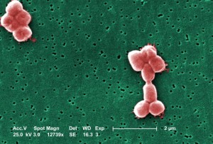 Acinetobacter baumannii Image/CDC/ Janice Haney Carr